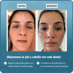 TU DUCHA MALTRATA TU PIEL Y CABELLO